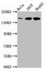 Western Blot<br />
 Positive WB detected in: Hela whole cell lysate, 293T whole cell lysate, HepG2 whole cell lysate<br />
 All lanes: LRPPRC antibody at 4µg/ml<br />
 Secondary<br />
 Goat polyclonal to rabbit IgG at 1/50000 dilution<br />
 Predicted band size: 158 kDa<br />
 Observed band size: 158 kDa<br />