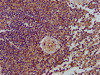 IHC image of CSB-PA013105LA01HU diluted at 1:400 and staining in paraffin-embedded human spleen tissue performed on a Leica BondTM system. After dewaxing and hydration, antigen retrieval was mediated by high pressure in a citrate buffer (pH 6.0) . Section was blocked with 10% normal goat serum 30min at RT. Then primary antibody (1% BSA) was incubated at 4°C overnight. The primary is detected by a biotinylated secondary antibody and visualized using an HRP conjugated SP system.
