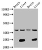 Western Blot<br />
 Positive WB detected in: Rat brain tissue, Rat liver tissue, Mouse brain tissue, Mouse liver tissue<br />
 All lanes: LSAMP antibody at 4.2µg/ml<br />
 Secondary<br />
 Goat polyclonal to rabbit IgG at 1/50000 dilution<br />
 Predicted band size: 38 kDa<br />
 Observed band size: 38 kDa<br />