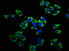 Immunofluorescence staining of A549 cells with CSB-PA013197LA01HU at 1:66, counter-stained with DAPI. The cells were fixed in 4% formaldehyde, permeabilized using 0.2% Triton X-100 and blocked in 10% normal Goat Serum. The cells were then incubated with the antibody overnight at 4°C. The secondary antibody was Alexa Fluor 488-congugated AffiniPure Goat Anti-Rabbit IgG (H+L) .