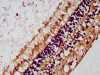 IHC image of CSB-PA013834LA01HU diluted at 1:200 and staining in paraffin-embedded human eye tissue performed on a Leica BondTM system. After dewaxing and hydration, antigen retrieval was mediated by high pressure in a citrate buffer (pH 6.0) . Section was blocked with 10% normal goat serum 30min at RT. Then primary antibody (1% BSA) was incubated at 4°C overnight. The primary is detected by a biotinylated secondary antibody and visualized using an HRP conjugated SP system.