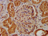 IHC image of CSB-PA015655LA01HU diluted at 1:400 and staining in paraffin-embedded human kidney tissue performed on a Leica BondTM system. After dewaxing and hydration, antigen retrieval was mediated by high pressure in a citrate buffer (pH 6.0) . Section was blocked with 10% normal goat serum 30min at RT. Then primary antibody (1% BSA) was incubated at 4°C overnight. The primary is detected by a biotinylated secondary antibody and visualized using an HRP conjugated SP system.