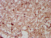 IHC image of CSB-PA016074LA01HU diluted at 1:200 and staining in paraffin-embedded human brain tissue performed on a Leica BondTM system. After dewaxing and hydration, antigen retrieval was mediated by high pressure in a citrate buffer (pH 6.0) . Section was blocked with 10% normal goat serum 30min at RT. Then primary antibody (1% BSA) was incubated at 4°C overnight. The primary is detected by a biotinylated secondary antibody and visualized using an HRP conjugated SP system.