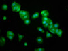 Immunofluorescence staining of HepG2 cells with CSB-PA016335LA01HU at 1:133, counter-stained with DAPI. The cells were fixed in 4% formaldehyde, permeabilized using 0.2% Triton X-100 and blocked in 10% normal Goat Serum. The cells were then incubated with the antibody overnight at 4°C. The secondary antibody was Alexa Fluor 488-congugated AffiniPure Goat Anti-Rabbit IgG (H+L) .