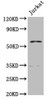 Western Blot<br />
 Positive WB detected in: Jurkat whole cell lysate<br />
 All lanes: PCCB antibody at 7.7µg/ml<br />
 Secondary<br />
 Goat polyclonal to rabbit IgG at 1/50000 dilution<br />
 Predicted band size: 59, 61 kDa<br />
 Observed band size: 59 kDa<br />