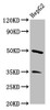 Western Blot<br />
 Positive WB detected in: HepG2 whole cell lysate<br />
 All lanes: PLA1A antibody at 3.4µg/ml<br />
 Secondary<br />
 Goat polyclonal to rabbit IgG at 1/50000 dilution<br />
 Predicted band size: 50, 41, 48, 32 kDa<br />
 Observed band size: 50 kDa<br />