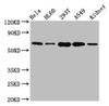 Western Blot<br />
 Positive WB detected in: Hela whole cell lysate, HL60 whole cell lysate, 293T whole cell lysate, A549 whole cell lysate, Mouse kidney tissue<br />
 All lanes: SLAMF6 antibody at 5.1µg/ml<br />
 Secondary<br />
 Goat polyclonal to rabbit IgG at 1/50000 dilution<br />
 Predicted band size: 38, 25 kDa<br />
 Observed band size: 60 kDa<br />