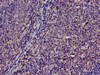 Immunohistochemistry of paraffin-embedded human lymph node tissue using CSB-PA023934LA01HU at dilution of 1:100 Immunohistochemistry of paraffin-embedded human lymph node tissue using CSB-PA023934LA01HU at dilution of 1:100