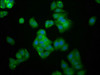 Immunofluorescence staining of HepG2 cells with CSB-PA025453LA01HU at 1:166, counter-stained with DAPI. The cells were fixed in 4% formaldehyde, permeabilized using 0.2% Triton X-100 and blocked in 10% normal Goat Serum. The cells were then incubated with the antibody overnight at 4°C. The secondary antibody was Alexa Fluor 488-congugated AffiniPure Goat Anti-Rabbit IgG (H+L) . Immunofluorescence staining of HepG2 cells with CSB-PA025453LA01HU at 1:166, counter-stained with DAPI. The cells were fixed in 4% formaldehyde, permeabilized using 0.2% Triton X-100 and blocked in 10% normal Goat Serum. The cells were then incubated with the antibody overnight at 4°C. The secondary antibody was Alexa Fluor 488-congugated AffiniPure Goat Anti-Rabbit IgG (H+L) .