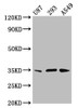 Western Blot<br />
 Positive WB detected in: U87 whole cell lysate, 293 whole cell lysate, A549 whole cell lysate<br />
 All lanes: VAX1 antibody at 3.8µg/ml<br />
 Secondary<br />
 Goat polyclonal to rabbit IgG at 1/50000 dilution<br />
 Predicted band size: 35, 22 kDa<br />
 Observed band size: 35 kDa<br /> Western Blot<br />
 Positive WB detected in: U87 whole cell lysate, 293 whole cell lysate, A549 whole cell lysate<br />
 All lanes: VAX1 antibody at 3.8µg/ml<br />
 Secondary<br />
 Goat polyclonal to rabbit IgG at 1/50000 dilution<br />
 Predicted band size: 35, 22 kDa<br />
 Observed band size: 35 kDa<br />