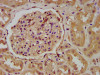 IHC image of CSB-PA026146LA01HU diluted at 1:200 and staining in paraffin-embedded human kidney tissue performed on a Leica BondTM system. After dewaxing and hydration, antigen retrieval was mediated by high pressure in a citrate buffer (pH 6.0) . Section was blocked with 10% normal goat serum 30min at RT. Then primary antibody (1% BSA) was incubated at 4°C overnight. The primary is detected by a biotinylated secondary antibody and visualized using an HRP conjugated SP system. IHC image of CSB-PA026146LA01HU diluted at 1:200 and staining in paraffin-embedded human kidney tissue performed on a Leica BondTM system. After dewaxing and hydration, antigen retrieval was mediated by high pressure in a citrate buffer (pH 6.0) . Section was blocked with 10% normal goat serum 30min at RT. Then primary antibody (1% BSA) was incubated at 4°C overnight. The primary is detected by a biotinylated secondary antibody and visualized using an HRP conjugated SP system.