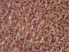 IHC image of CSB-PA22969A0Rb diluted at 1:600 and staining in paraffin-embedded human adrenal gland tissue performed on a Leica BondTM system. After dewaxing and hydration, antigen retrieval was mediated by high pressure in a citrate buffer (pH 6.0) . Section was blocked with 10% normal goat serum 30min at RT. Then primary antibody (1% BSA) was incubated at 4°C overnight. The primary is detected by a biotinylated secondary antibody and visualized using an HRP conjugated SP system. IHC image of CSB-PA22969A0Rb diluted at 1:600 and staining in paraffin-embedded human adrenal gland tissue performed on a Leica BondTM system. After dewaxing and hydration, antigen retrieval was mediated by high pressure in a citrate buffer (pH 6.0) . Section was blocked with 10% normal goat serum 30min at RT. Then primary antibody (1% BSA) was incubated at 4°C overnight. The primary is detected by a biotinylated secondary antibody and visualized using an HRP conjugated SP system.