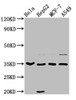 Western Blot<br />
 Positive WB detected in: Hela whole cell lysate, HepG2 whole cell lysate, MCF-7 whole cell lysate, A549 whole cell lysate<br />
 All lanes: AIMP1 antibody at 3.7µg/ml<br />
 Secondary<br />
 Goat polyclonal to rabbit IgG at 1/50000 dilution<br />
 Predicted band size: 35, 38 kDa<br />
 Observed band size: 35 kDa<br /> Western Blot<br />
 Positive WB detected in: Hela whole cell lysate, HepG2 whole cell lysate, MCF-7 whole cell lysate, A549 whole cell lysate<br />
 All lanes: AIMP1 antibody at 3.7µg/ml<br />
 Secondary<br />
 Goat polyclonal to rabbit IgG at 1/50000 dilution<br />
 Predicted band size: 35, 38 kDa<br />
 Observed band size: 35 kDa<br />