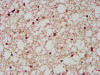 IHC image of CSB-PA618638EA01HU diluted at 1:200 and staining in paraffin-embedded human brain tissue performed on a Leica BondTM system. After dewaxing and hydration, antigen retrieval was mediated by high pressure in a citrate buffer (pH 6.0) . Section was blocked with 10% normal goat serum 30min at RT. Then primary antibody (1% BSA) was incubated at 4°C overnight. The primary is detected by a biotinylated secondary antibody and visualized using an HRP conjugated SP system.