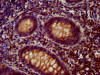 IHC image of CSB-PA753588LA01HU diluted at 1:400 and staining in paraffin-embedded human appendix tissue performed on a Leica BondTM system. After dewaxing and hydration, antigen retrieval was mediated by high pressure in a citrate buffer (pH 6.0) . Section was blocked with 10% normal goat serum 30min at RT. Then primary antibody (1% BSA) was incubated at 4°C overnight. The primary is detected by a biotinylated secondary antibody and visualized using an HRP conjugated SP system. IHC image of CSB-PA753588LA01HU diluted at 1:400 and staining in paraffin-embedded human appendix tissue performed on a Leica BondTM system. After dewaxing and hydration, antigen retrieval was mediated by high pressure in a citrate buffer (pH 6.0) . Section was blocked with 10% normal goat serum 30min at RT. Then primary antibody (1% BSA) was incubated at 4°C overnight. The primary is detected by a biotinylated secondary antibody and visualized using an HRP conjugated SP system.