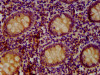 IHC image of CSB-PA769772LA01HU diluted at 1:400 and staining in paraffin-embedded human appendix tissue performed on a Leica BondTM system. After dewaxing and hydration, antigen retrieval was mediated by high pressure in a citrate buffer (pH 6.0) . Section was blocked with 10% normal goat serum 30min at RT. Then primary antibody (1% BSA) was incubated at 4°C overnight. The primary is detected by a biotinylated secondary antibody and visualized using an HRP conjugated SP system.