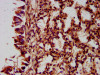 IHC image of CSB-PA771457LA01HU diluted at 1:400 and staining in paraffin-embedded human lung tissue performed on a Leica BondTM system. After dewaxing and hydration, antigen retrieval was mediated by high pressure in a citrate buffer (pH 6.0) . Section was blocked with 10% normal goat serum 30min at RT. Then primary antibody (1% BSA) was incubated at 4°C overnight. The primary is detected by a biotinylated secondary antibody and visualized using an HRP conjugated SP system.