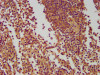 IHC image of CSB-PA771457LA01HU diluted at 1:400 and staining in paraffin-embedded human spleen tissue performed on a Leica BondTM system. After dewaxing and hydration, antigen retrieval was mediated by high pressure in a citrate buffer (pH 6.0) . Section was blocked with 10% normal goat serum 30min at RT. Then primary antibody (1% BSA) was incubated at 4°C overnight. The primary is detected by a biotinylated secondary antibody and visualized using an HRP conjugated SP system.