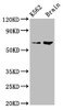 Western Blot<br />
 Positive WB detected in: K562 whole cell lysate, Rat brain tissue<br />
 All lanes: BRAP antibody at 7.5µg/ml<br />
 Secondary<br />
 Goat polyclonal to rabbit IgG at 1/50000 dilution<br />
 Predicted band size: 68, 48 kDa<br />
 Observed band size: 68 kDa<br />