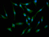 Immunofluorescence staining of Hela cells with CSB-PA814219LA01HU at 1:133, counter-stained with DAPI. The cells were fixed in 4% formaldehyde, permeabilized using 0.2% Triton X-100 and blocked in 10% normal Goat Serum. The cells were then incubated with the antibody overnight at 4°C. The secondary antibody was Alexa Fluor 488-congugated AffiniPure Goat Anti-Rabbit IgG (H+L) .