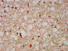 IHC image of CSB-PA816901LA01HU diluted at 1:500 and staining in paraffin-embedded human brain tissue performed on a Leica BondTM system. After dewaxing and hydration, antigen retrieval was mediated by high pressure in a citrate buffer (pH 6.0) . Section was blocked with 10% normal goat serum 30min at RT. Then primary antibody (1% BSA) was incubated at 4°C overnight. The primary is detected by a biotinylated secondary antibody and visualized using an HRP conjugated SP system.