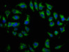 Immunofluorescence staining of A549 cells with CSB-PA821705LA01HU at 1:133, counter-stained with DAPI. The cells were fixed in 4% formaldehyde, permeabilized using 0.2% Triton X-100 and blocked in 10% normal Goat Serum. The cells were then incubated with the antibody overnight at 4°C. The secondary antibody was Alexa Fluor 488-congugated AffiniPure Goat Anti-Rabbit IgG (H+L) .