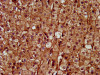 IHC image of CSB-PA836208LA01HU diluted at 1:400 and staining in paraffin-embedded human adrenal gland tissue performed on a Leica BondTM system. After dewaxing and hydration, antigen retrieval was mediated by high pressure in a citrate buffer (pH 6.0) . Section was blocked with 10% normal goat serum 30min at RT. Then primary antibody (1% BSA) was incubated at 4°C overnight. The primary is detected by a biotinylated secondary antibody and visualized using an HRP conjugated SP system.
