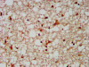 IHC image of CSB-PA836272LA01HU diluted at 1:300 and staining in paraffin-embedded human brain tissue performed on a Leica BondTM system. After dewaxing and hydration, antigen retrieval was mediated by high pressure in a citrate buffer (pH 6.0) . Section was blocked with 10% normal goat serum 30min at RT. Then primary antibody (1% BSA) was incubated at 4°C overnight. The primary is detected by a biotinylated secondary antibody and visualized using an HRP conjugated SP system.