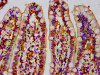 IHC image of CSB-PA836272LA01HU diluted at 1:300 and staining in paraffin-embedded human small intestine tissue performed on a Leica BondTM system. After dewaxing and hydration, antigen retrieval was mediated by high pressure in a citrate buffer (pH 6.0) . Section was blocked with 10% normal goat serum 30min at RT. Then primary antibody (1% BSA) was incubated at 4°C overnight. The primary is detected by a biotinylated secondary antibody and visualized using an HRP conjugated SP system.