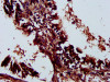 IHC image of CSB-PA836677LA01HU diluted at 1:300 and staining in paraffin-embedded human lung tissue performed on a Leica BondTM system. After dewaxing and hydration, antigen retrieval was mediated by high pressure in a citrate buffer (pH 6.0) . Section was blocked with 10% normal goat serum 30min at RT. Then primary antibody (1% BSA) was incubated at 4°C overnight. The primary is detected by a biotinylated secondary antibody and visualized using an HRP conjugated SP system.