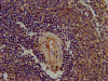 IHC image of CSB-PA842706LA01HU diluted at 1:400 and staining in paraffin-embedded human spleen tissue performed on a Leica BondTM system. After dewaxing and hydration, antigen retrieval was mediated by high pressure in a citrate buffer (pH 6.0) . Section was blocked with 10% normal goat serum 30min at RT. Then primary antibody (1% BSA) was incubated at 4°C overnight. The primary is detected by a biotinylated secondary antibody and visualized using an HRP conjugated SP system.