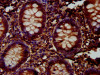 IHC image of CSB-PA847604LA01HU diluted at 1:300 and staining in paraffin-embedded human appendix tissue performed on a Leica BondTM system. After dewaxing and hydration, antigen retrieval was mediated by high pressure in a citrate buffer (pH 6.0) . Section was blocked with 10% normal goat serum 30min at RT. Then primary antibody (1% BSA) was incubated at 4°C overnight. The primary is detected by a biotinylated secondary antibody and visualized using an HRP conjugated SP system.