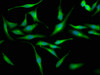 Immunofluorescence staining of Hela cells with CSB-PA850272LA01HU at 1:133, counter-stained with DAPI. The cells were fixed in 4% formaldehyde, permeabilized using 0.2% Triton X-100 and blocked in 10% normal Goat Serum. The cells were then incubated with the antibody overnight at 4°C. The secondary antibody was Alexa Fluor 488-congugated AffiniPure Goat Anti-Rabbit IgG (H+L) . Immunofluorescence staining of Hela cells with CSB-PA850272LA01HU at 1:133, counter-stained with DAPI. The cells were fixed in 4% formaldehyde, permeabilized using 0.2% Triton X-100 and blocked in 10% normal Goat Serum. The cells were then incubated with the antibody overnight at 4°C. The secondary antibody was Alexa Fluor 488-congugated AffiniPure Goat Anti-Rabbit IgG (H+L) .