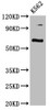 Western Blot<br />
 Positive WB detected in: K562 whole cell lysate<br />
 All lanes: CLPTM1L antibody at 3.7µg/ml<br />
 Secondary<br />
 Goat polyclonal to rabbit IgG at 1/50000 dilution<br />
 Predicted band size: 63, 59 kDa<br />
 Observed band size: 63 kDa<br />