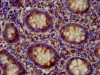 IHC image of CSB-PA850779LA01HU diluted at 1:200 and staining in paraffin-embedded human appendix tissue performed on a Leica BondTM system. After dewaxing and hydration, antigen retrieval was mediated by high pressure in a citrate buffer (pH 6.0) . Section was blocked with 10% normal goat serum 30min at RT. Then primary antibody (1% BSA) was incubated at 4°C overnight. The primary is detected by a biotinylated secondary antibody and visualized using an HRP conjugated SP system.
