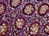 IHC image of CSB-PA853382LA01HU diluted at 1:500 and staining in paraffin-embedded human appendix tissue performed on a Leica BondTM system. After dewaxing and hydration, antigen retrieval was mediated by high pressure in a citrate buffer (pH 6.0) . Section was blocked with 10% normal goat serum 30min at RT. Then primary antibody (1% BSA) was incubated at 4°C overnight. The primary is detected by a biotinylated secondary antibody and visualized using an HRP conjugated SP system.