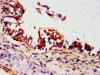 IHC image of CSB-PA854016LA01HU diluted at 1:500 and staining in paraffin-embedded human lung tissue performed on a Leica BondTM system. After dewaxing and hydration, antigen retrieval was mediated by high pressure in a citrate buffer (pH 6.0) . Section was blocked with 10% normal goat serum 30min at RT. Then primary antibody (1% BSA) was incubated at 4°C overnight. The primary is detected by a biotinylated secondary antibody and visualized using an HRP conjugated SP system.