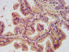 IHC image of CSB-PA859515LA01HU diluted at 1:400 and staining in paraffin-embedded human prostate tissue performed on a Leica BondTM system. After dewaxing and hydration, antigen retrieval was mediated by high pressure in a citrate buffer (pH 6.0) . Section was blocked with 10% normal goat serum 30min at RT. Then primary antibody (1% BSA) was incubated at 4°C overnight. The primary is detected by a biotinylated secondary antibody and visualized using an HRP conjugated SP system.