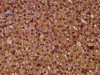 IHC image of CSB-PA860652LA01HU diluted at 1:400 and staining in paraffin-embedded human adrenal gland tissue performed on a Leica BondTM system. After dewaxing and hydration, antigen retrieval was mediated by high pressure in a citrate buffer (pH 6.0) . Section was blocked with 10% normal goat serum 30min at RT. Then primary antibody (1% BSA) was incubated at 4°C overnight. The primary is detected by a biotinylated secondary antibody and visualized using an HRP conjugated SP system.