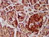 IHC image of CSB-PA866200LA01HU diluted at 1:400 and staining in paraffin-embedded human pancreatic tissue performed on a Leica BondTM system. After dewaxing and hydration, antigen retrieval was mediated by high pressure in a citrate buffer (pH 6.0) . Section was blocked with 10% normal goat serum 30min at RT. Then primary antibody (1% BSA) was incubated at 4°C overnight. The primary is detected by a biotinylated secondary antibody and visualized using an HRP conjugated SP system.