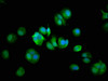 Immunofluorescence staining of MCF-7 cells with CSB-PA866200LA01HU at 1:133, counter-stained with DAPI. The cells were fixed in 4% formaldehyde, permeabilized using 0.2% Triton X-100 and blocked in 10% normal Goat Serum. The cells were then incubated with the antibody overnight at 4°C. The secondary antibody was Alexa Fluor 488-congugated AffiniPure Goat Anti-Rabbit IgG (H+L) .