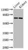 Western Blot<br />
 Positive WB detected in: Mouse liver tissue, Mouse kidney tissue<br />
 All lanes: PRDM5 antibody at 3µg/ml<br />
 Secondary<br />
 Goat polyclonal to rabbit IgG at 1/50000 dilution<br />
 Predicted band size: 74, 70, 13, 59 kDa<br />
 Observed band size: 74 kDa<br />
