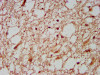 IHC image of CSB-PA884426LA01HU diluted at 1:600 and staining in paraffin-embedded human brain tissue performed on a Leica BondTM system. After dewaxing and hydration, antigen retrieval was mediated by high pressure in a citrate buffer (pH 6.0) . Section was blocked with 10% normal goat serum 30min at RT. Then primary antibody (1% BSA) was incubated at 4°C overnight. The primary is detected by a biotinylated secondary antibody and visualized using an HRP conjugated SP system.