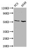Western Blot<br />
 Positive WB detected in: PC-3 whole cell lysate, A549 whole cell lysate<br />
 All lanes: ETV5 antibody at 4.6µg/ml<br />
 Secondary<br />
 Goat polyclonal to rabbit IgG at 1/50000 dilution<br />
 Predicted band size: 58, 63 kDa<br />
 Observed band size: 58 kDa<br />