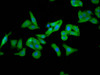 Immunofluorescence staining of HepG2 cells with CSB-PA008784LA01HU at 1:266, counter-stained with DAPI. The cells were fixed in 4% formaldehyde, permeabilized using 0.2% Triton X-100 and blocked in 10% normal Goat Serum. The cells were then incubated with the antibody overnight at 4°C. The secondary antibody was Alexa Fluor 488-congugated AffiniPure Goat Anti-Rabbit IgG (H+L) .