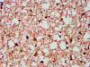 IHC image of CSB-PA009716LA01HU diluted at 1:300 and staining in paraffin-embedded human brain tissue performed on a Leica BondTM system. After dewaxing and hydration, antigen retrieval was mediated by high pressure in a citrate buffer (pH 6.0) . Section was blocked with 10% normal goat serum 30min at RT. Then primary antibody (1% BSA) was incubated at 4°C overnight. The primary is detected by a biotinylated secondary antibody and visualized using an HRP conjugated SP system.