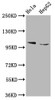 Western Blot<br />
 Positive WB detected in: Hela whole cell lysate, HepG2 whole cell lysate<br />
 All lanes: IKBKAP antibody at 5.3µg/ml<br />
 Secondary<br />
 Goat polyclonal to rabbit IgG at 1/50000 dilution<br />
 Predicted band size: 151 kDa<br />
 Observed band size: 151 kDa<br />