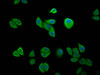 Immunofluorescence staining of Hela cells with CSB-PA011571LA01HU at 1:200, counter-stained with DAPI. The cells were fixed in 4% formaldehyde, permeabilized using 0.2% Triton X-100 and blocked in 10% normal Goat Serum. The cells were then incubated with the antibody overnight at 4°C. The secondary antibody was Alexa Fluor 488-congugated AffiniPure Goat Anti-Rabbit IgG (H+L) .