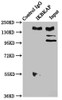 Immunoprecipitating IKBKAP in Hela whole cell lysate<br />
 Lane 1: Rabbit control IgG instead of CSB-PA011571LA01HU in Hela whole cell lysate.
 For western blotting, a HRP-conjugated Protein G antibody was used as the secondary antibody (1/2000) <br />
 Lane 2: CSB-PA011571LA01HU (6µg) + Hela whole cell lysate (1mg) <br />
 Lane 3: Hela whole cell lysate (20µg) <br />