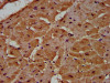 IHC image of CSB-PA013571LA01HU diluted at 1:500 and staining in paraffin-embedded human heart tissue performed on a Leica BondTM system. After dewaxing and hydration, antigen retrieval was mediated by high pressure in a citrate buffer (pH 6.0) . Section was blocked with 10% normal goat serum 30min at RT. Then primary antibody (1% BSA) was incubated at 4°C overnight. The primary is detected by a biotinylated secondary antibody and visualized using an HRP conjugated SP system.